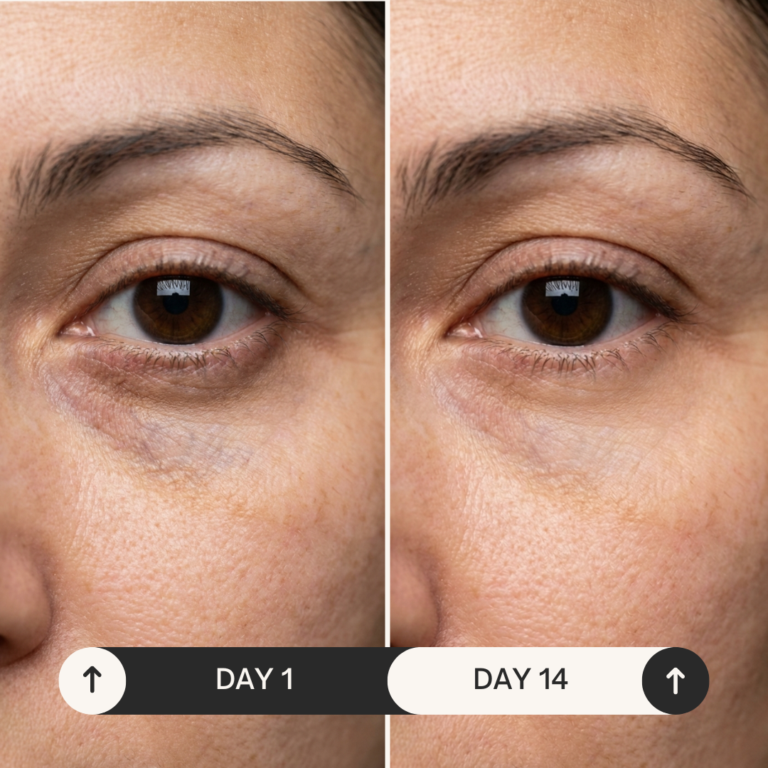 Wake Up Looking Rested, Even When You're Not — LumaEye Red Light Therapy Eye Mask